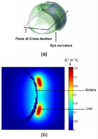 thermalcontour